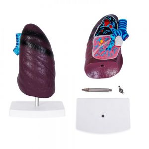 MODELO NEUMO personalizada